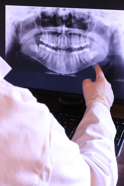 Best Emergency Dentist for Lost Fillings or Crowns in Mckinley, PA