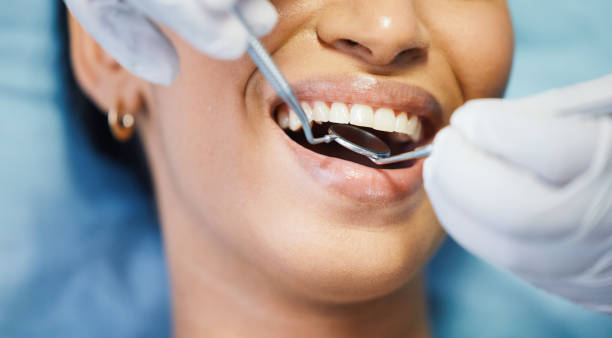 Best Emergency Dental Extractions in Mckinley, PA
